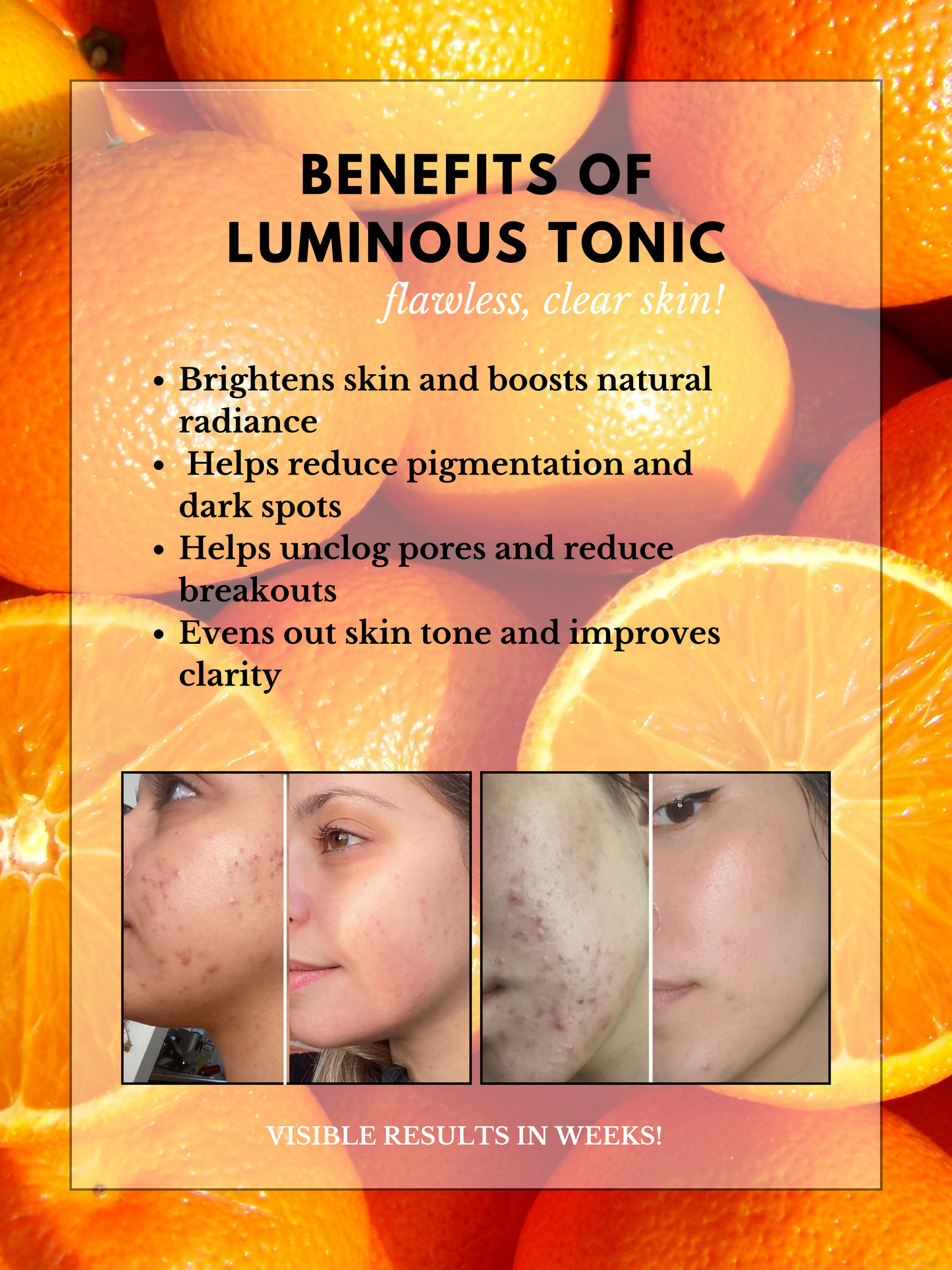 - THE SKIN RESET BUNDLE | LIMITED TIME OFFER